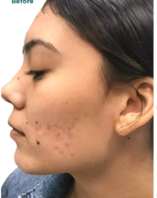 Before treatment