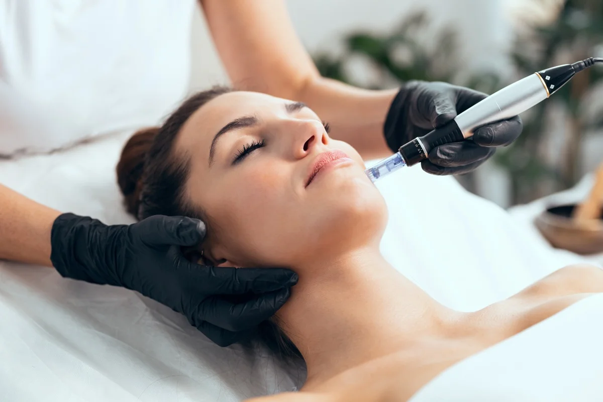 Microneedling treatment close-up