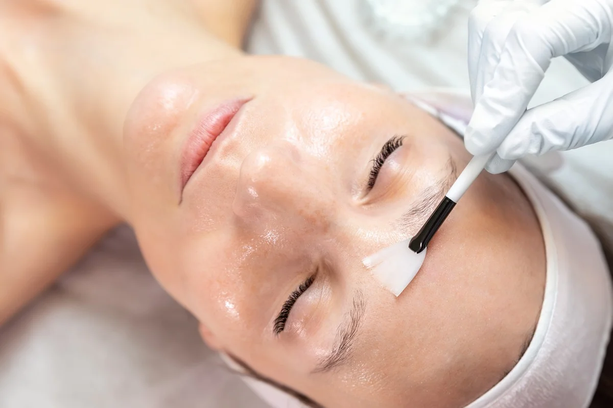 Chemical peel treatment
